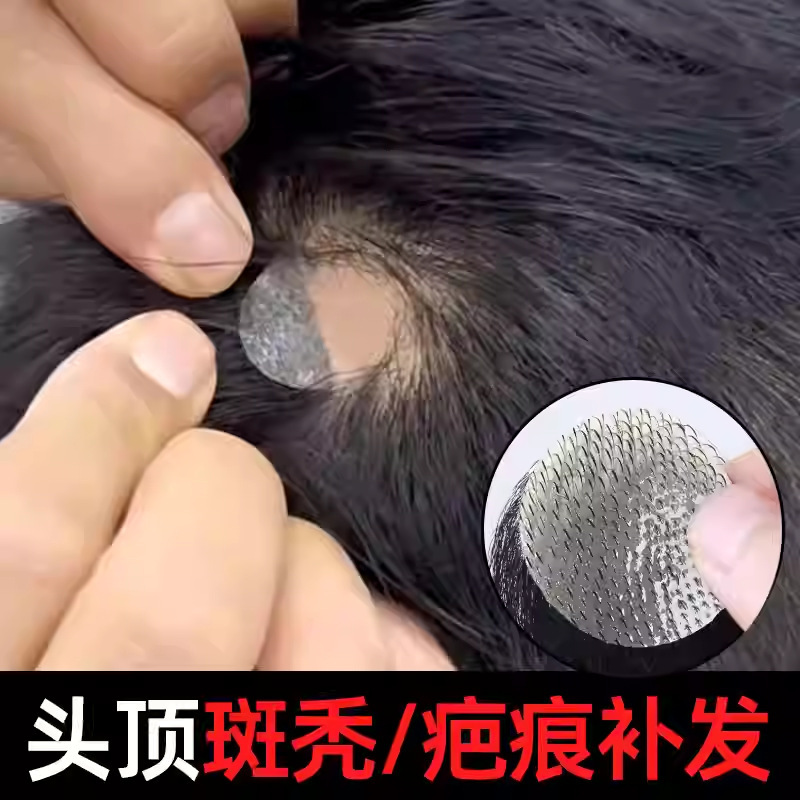 Men's Sideburn Scar Patch Hair Replacement Piece for Thinning Hair, Real Hair Small Area Replacement Piece Wig Patch