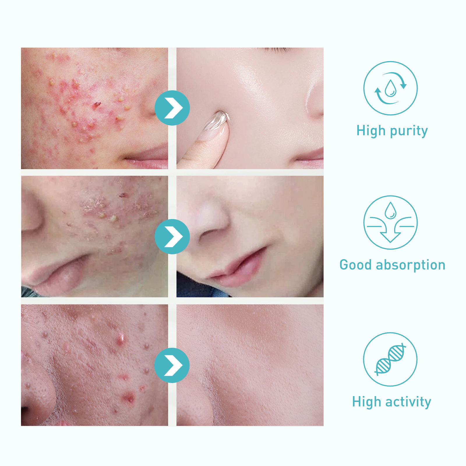 Il gel riparatore Jayusing schiarisce i segni, le macchie dell'acne, ripara, idrata e illumina la pelle_voghion.com