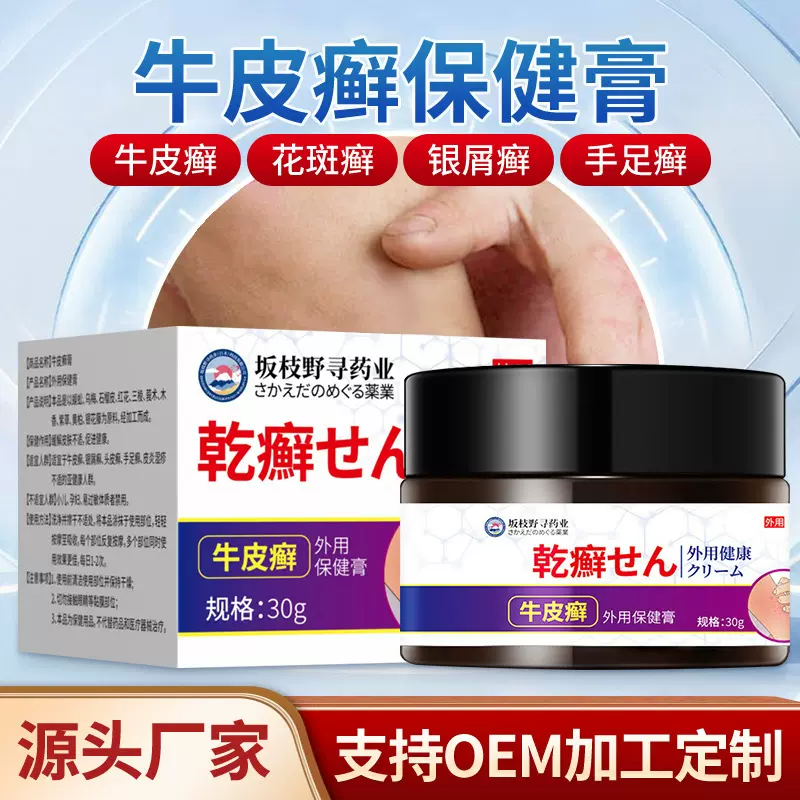 牛皮藓专用膏缓解牛皮藓乳膏修护皮肤瘙痒不适止痒牛皮藓专用膏