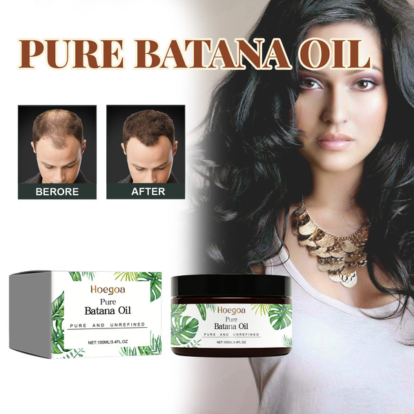 HOEGOA Batana hair care oil cares the scalp to moisturize the dry…