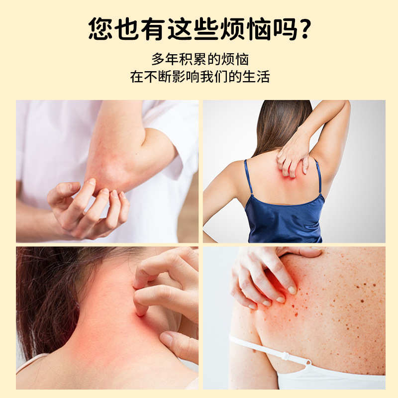 五毒止痒膏抑菌外用50g草本止痒乳膏工厂批发代发|undefined