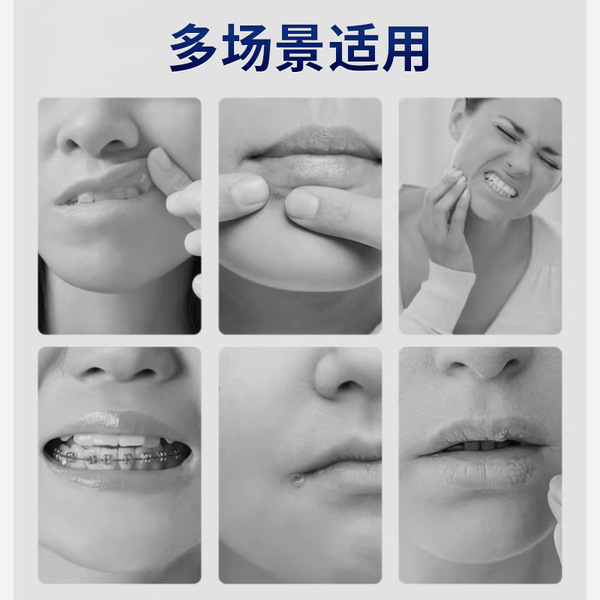 Oral ulcer film