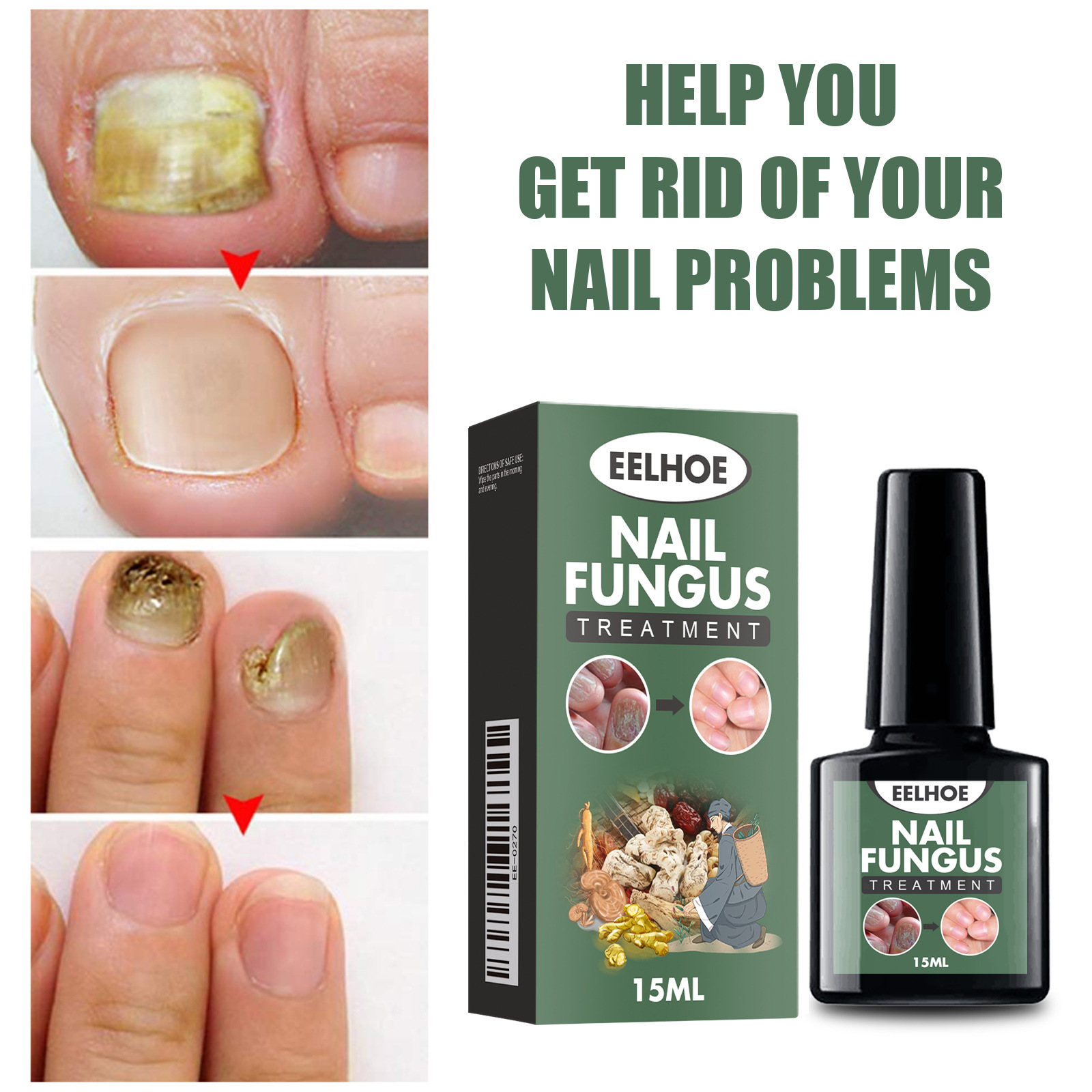 Eelhoe Hand and Foot Nail Care Solution Hand and Foot Nail Moisturizing Care Soft Nail Care Solution