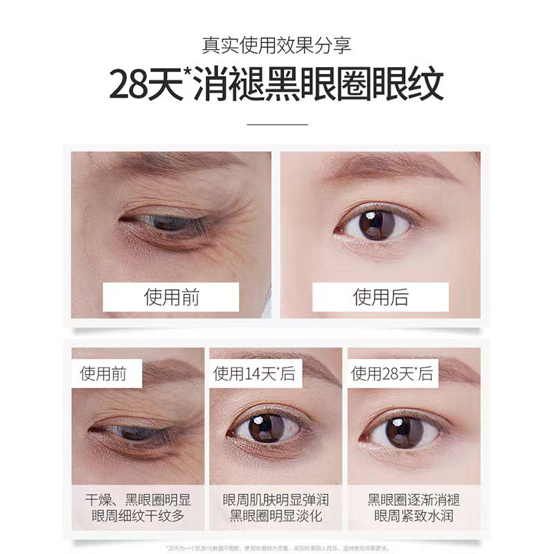 眼霜去皱紧致批发抗皱去淡化细纹脂肪粒鱼子酱眼霜祛眼袋黑眼圈|undefined