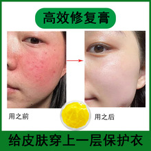 高效修复膏去红血丝修复激素脸敏感肌增厚角质层润肤有效修正皮肤