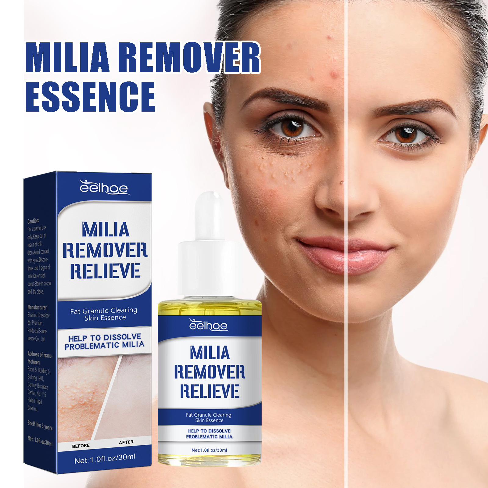 Millet Repair Beautiful essence Deeply Cleans Pores, Lightens Acne, Millet Repair Skin Barrier essence_voghion.com