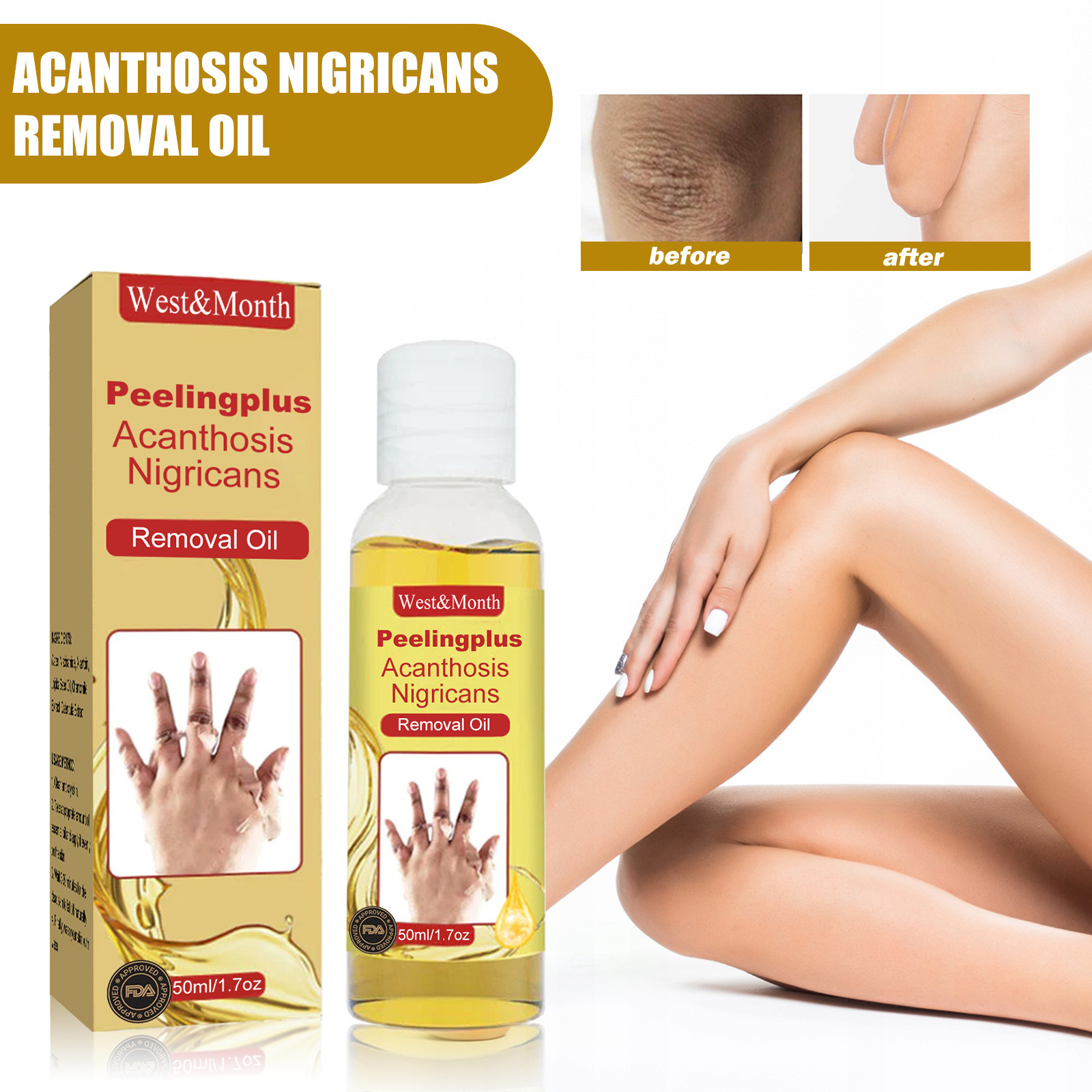Huile éclaircissante pour traitement de l'acanthosis nigricans_voghion.com