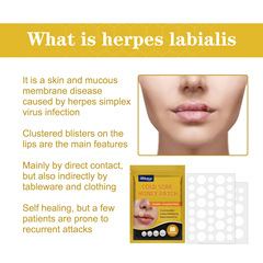 South Moon Lip Bubble Patch for Relief of Perioral Keratosis Granules Hydrocolloid Lip Care Bubble Patch