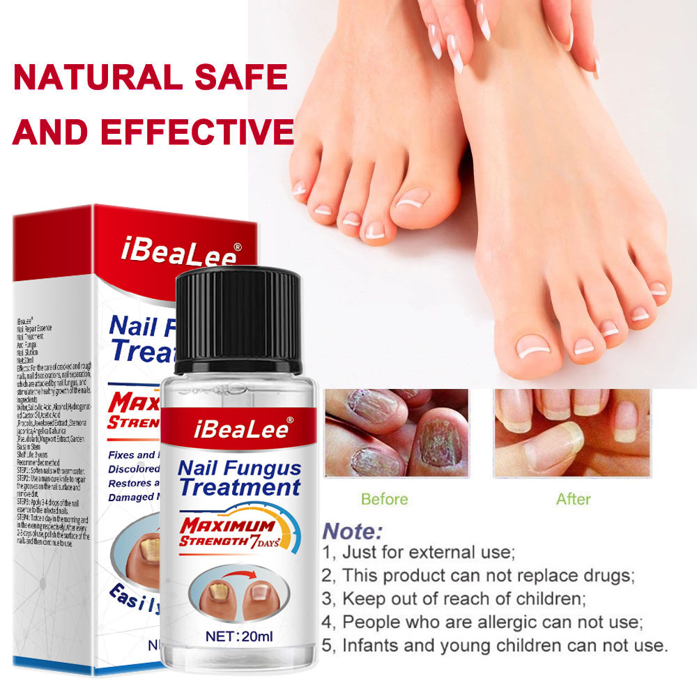 Líquido antibacteriano Crema de eliminación IBeaLee Poción especial espesante para uñas grises suaves_voghion.com