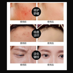 院線高端玻色因小繃帶修護面霜高濃度 黑繃帶玻色因抗皺緊緻晚霜