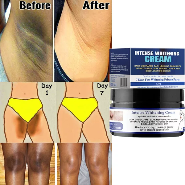 Whitening Cream Cross-Border Snow-White Private Cream for Brightening and Rejuvenating Skin Underarms and Inner Thighs Brightening and Dark Spot Removal Cream