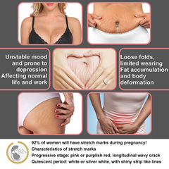 Wiieey Postpartum Pregnancy Repair Cream&mdash;Lightens Fine Lines Caused by Pregnancy, Provides Massage and Firming Effects, and Nourishes Postpartum Skin