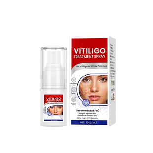 Vitiligo Treatment Spray Skin Spray Gentle Care Skin