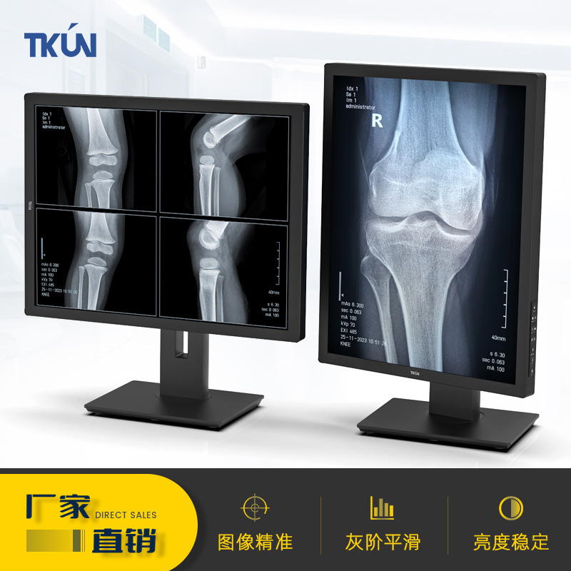 213-Inch 3m Vertical Screen X-Ray Machine Dicom Medical Ips Touch Screen Dicom Certified Monitor Lcd Screen