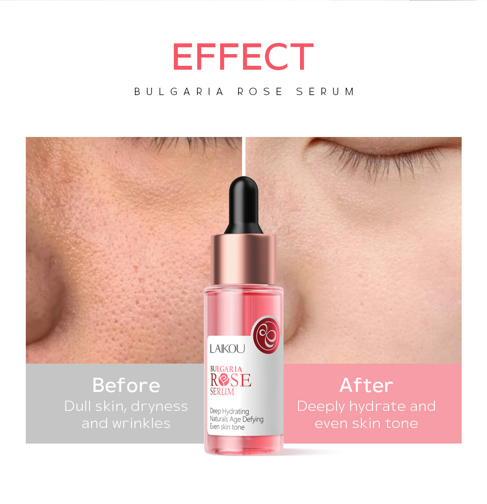 LAIKOU Rose Essence 30ml Hydrating, moisturizing and nourishing skin Facial care essence manufacturer in stock wholesale undefined