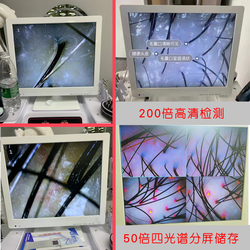 頭皮検査理学療法器理髪店毛包高清一体機頭治療機多機能頭部看護美容器|undefined