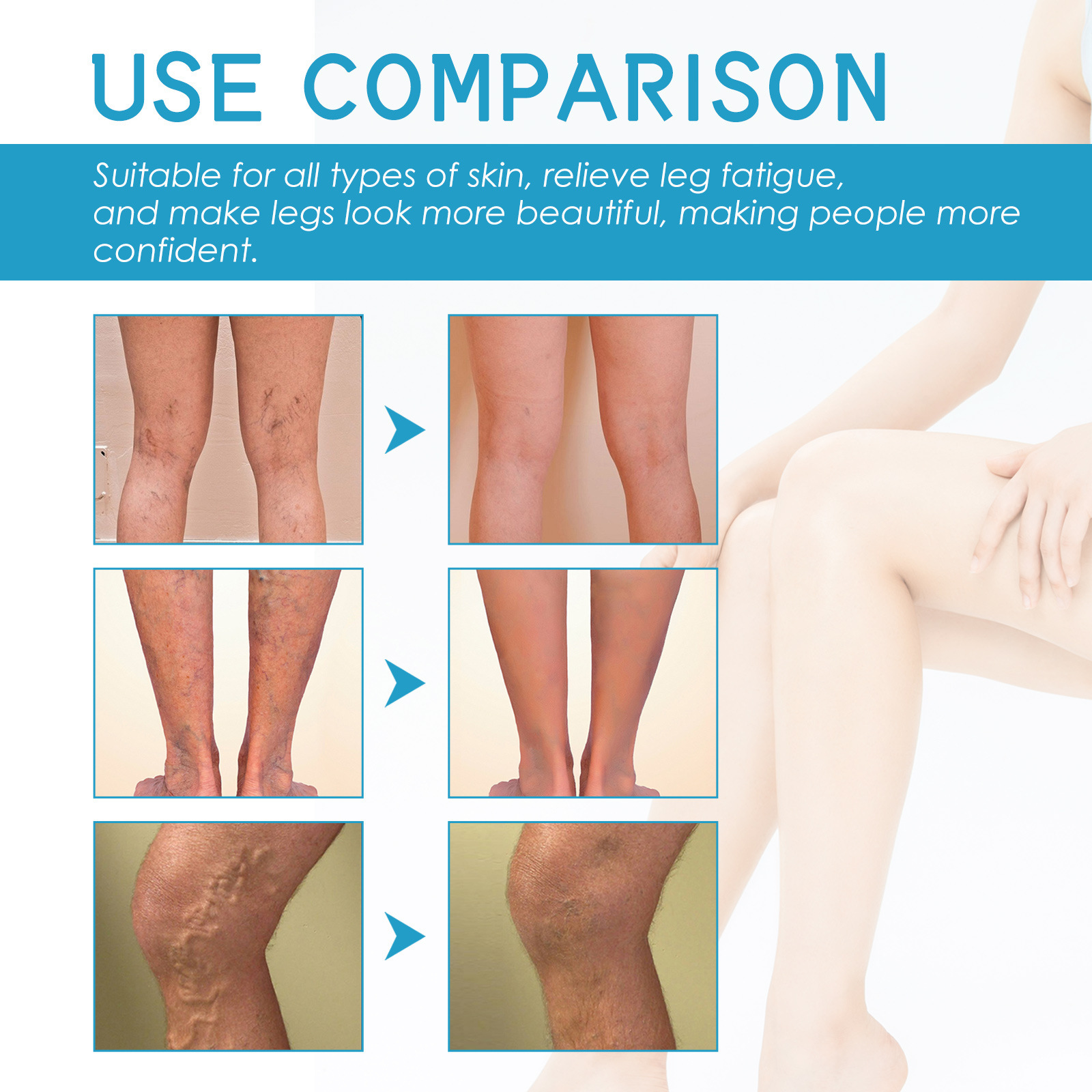Lindert West&Month Repair Pain Regenwurm Bein prall gefüllte Venenpflege-Massagecreme_voghion.com