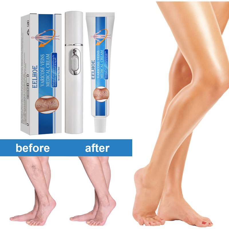 EELHOE Intravenous Massage Cream to Slow the Venous Vein Massage to Relieve the Pain of Blood Vessels in the Legs