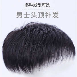 男士短发假发头套全真发补发块轻薄遮秃顶帅气毛寸碎发头顶补发片