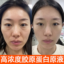 �zԭ����ԭҺ�����o�¸��ƶ���ȥ������y����ؽM�aˮ�������AҺ