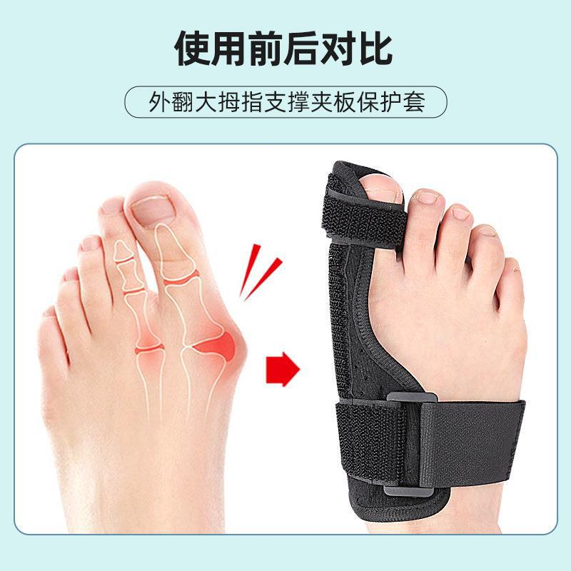 男女兼用外反母趾サポート装具、親指保護カバー、足指セパレーター、二重圧力調整固定ベルト|undefined