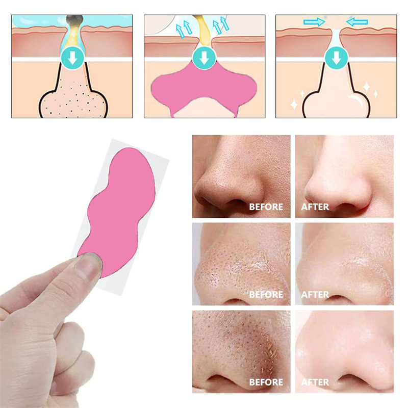 Crazylife Pink Tear Black T-Zone Nasenmaske, 10er-Packung/Box_voghion.com