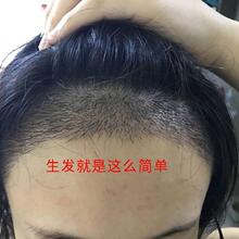 �����f�����l�۲��������lҺ���L�ܰl�^�l�������LҺ�l�H���d�