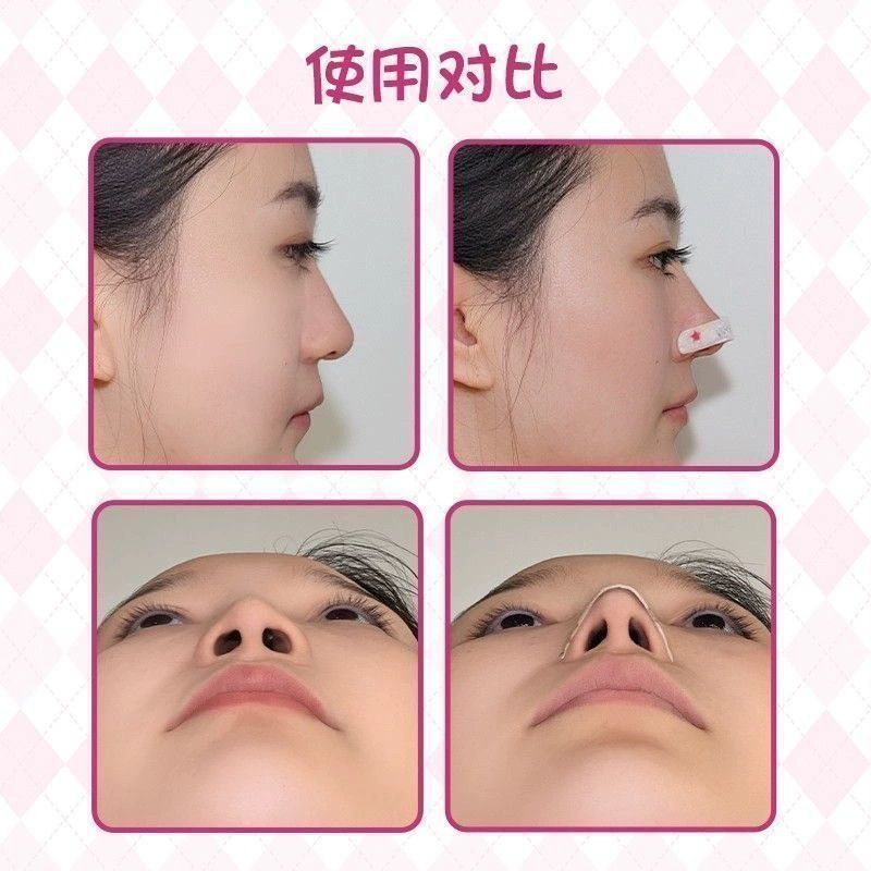 Xpress Nose Patch Adjustable Memory Cutting Nose Wing Reduction Patch Correction Shaping Nose Patch Directly from the Manufacturer