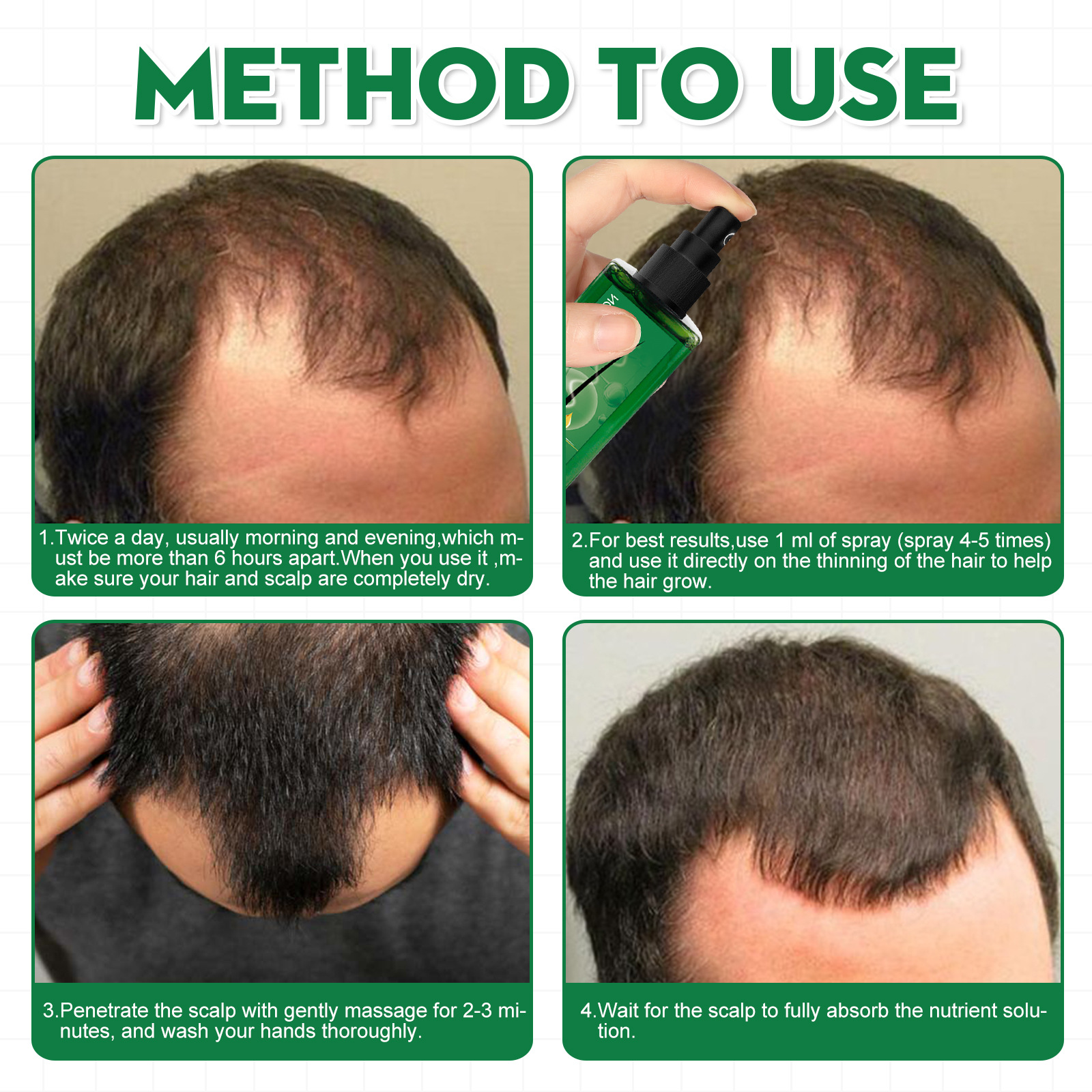 Soluzione nutriente per la crescita dei capelli da uomo: formula nutriente per capelli più spessi e folti_voghion.com
