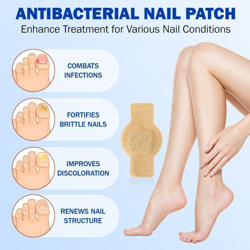 跨境ELAIMEI 指甲抑菌贴嵌甲灰甲厚甲恢复贴Bacteriostatic patch|undefined