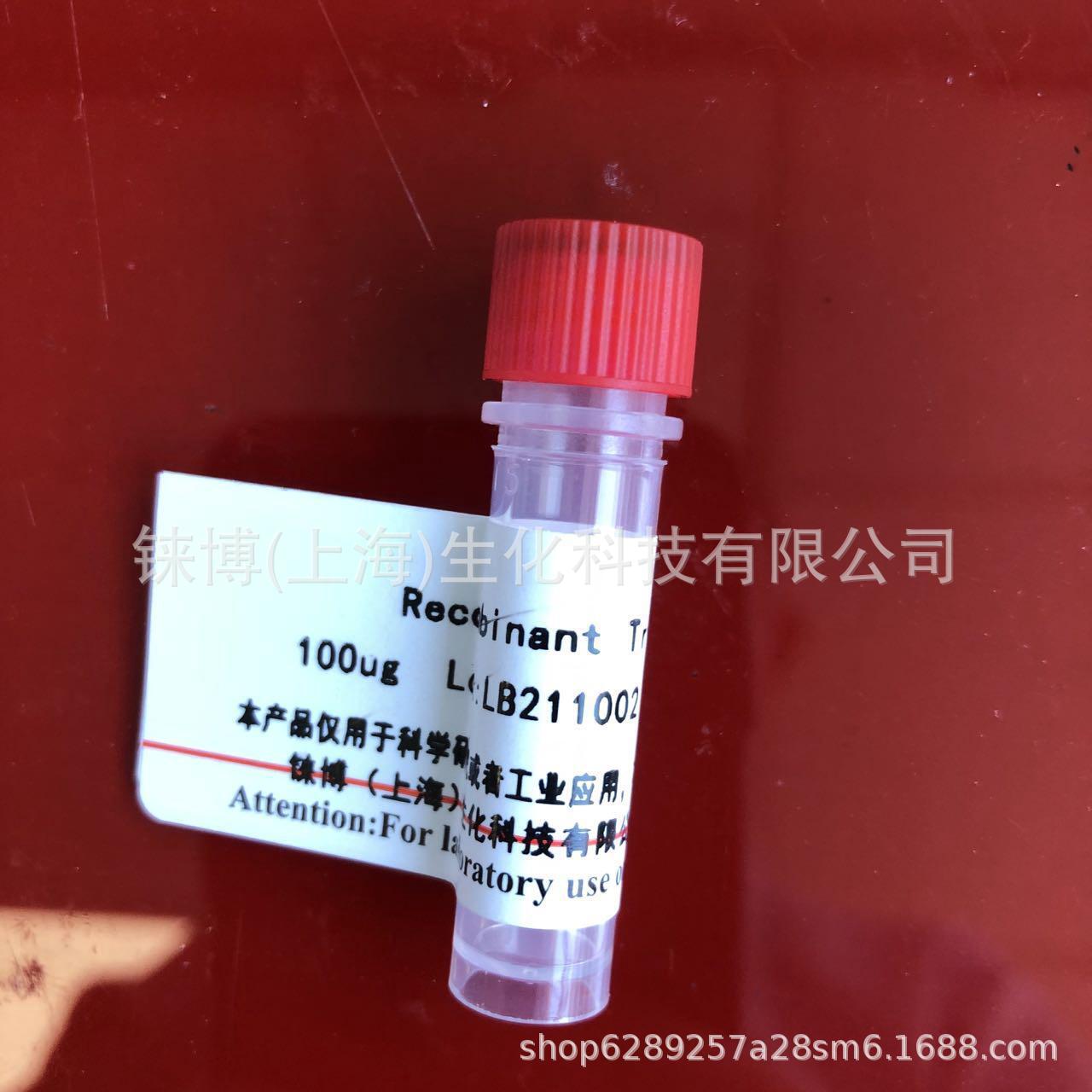 兔抗人血清白蛋白   包邮