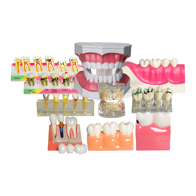 Modelo dental molde modelo dental modelo de enseñanza dental removible dentadura oral cepillado Preparación del diente modelo resina