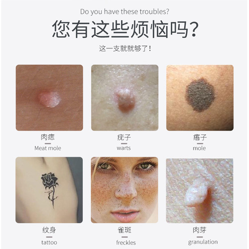 Cross-border smart LCD facial spot pen laser beauty machine home spot removal and spot scanning pen beauty instrument