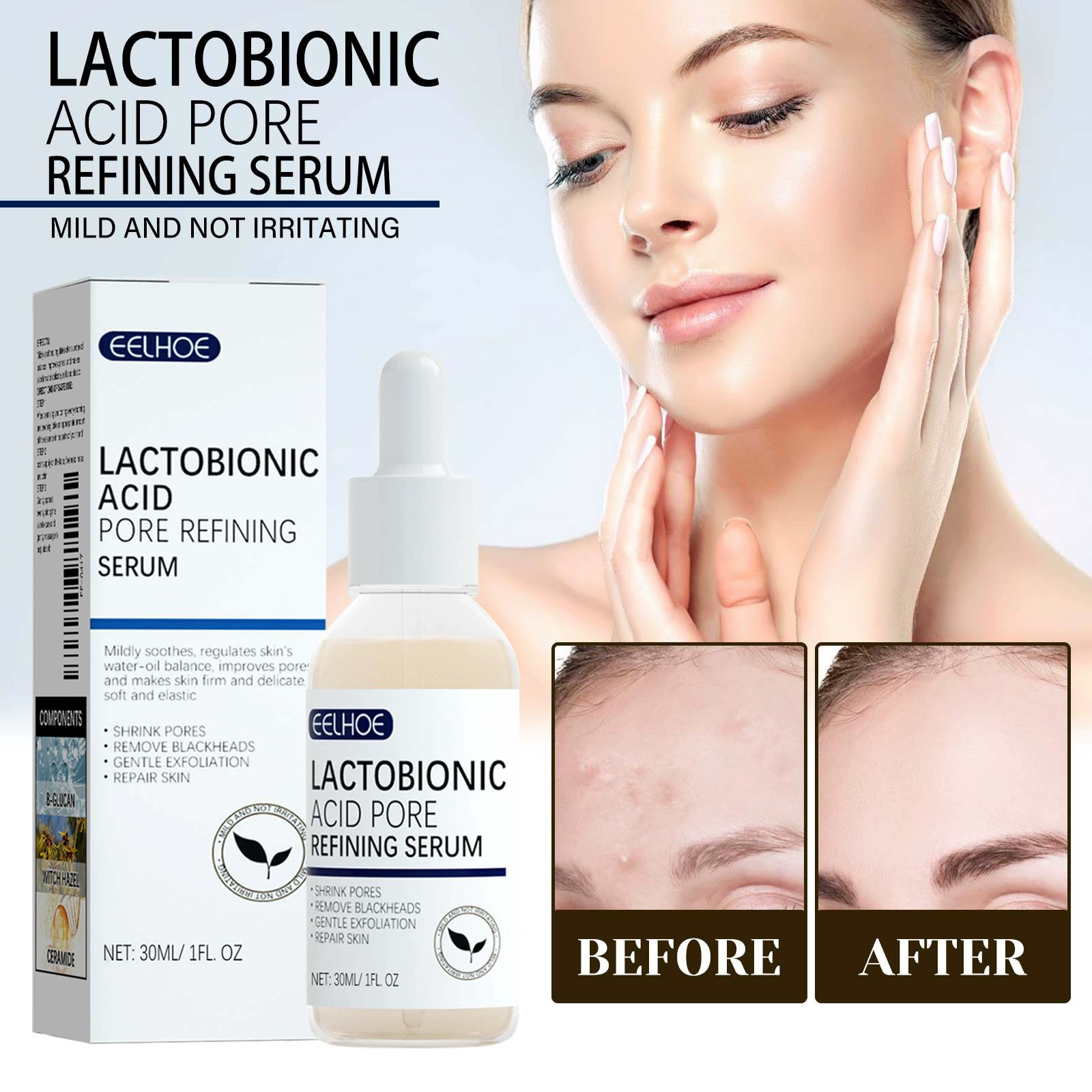 EELHOE лактонат, сокращающий поры, сыворотка, увлажняющий кожу, нежный и восстанавливающий Чистый угри, уход за кожей