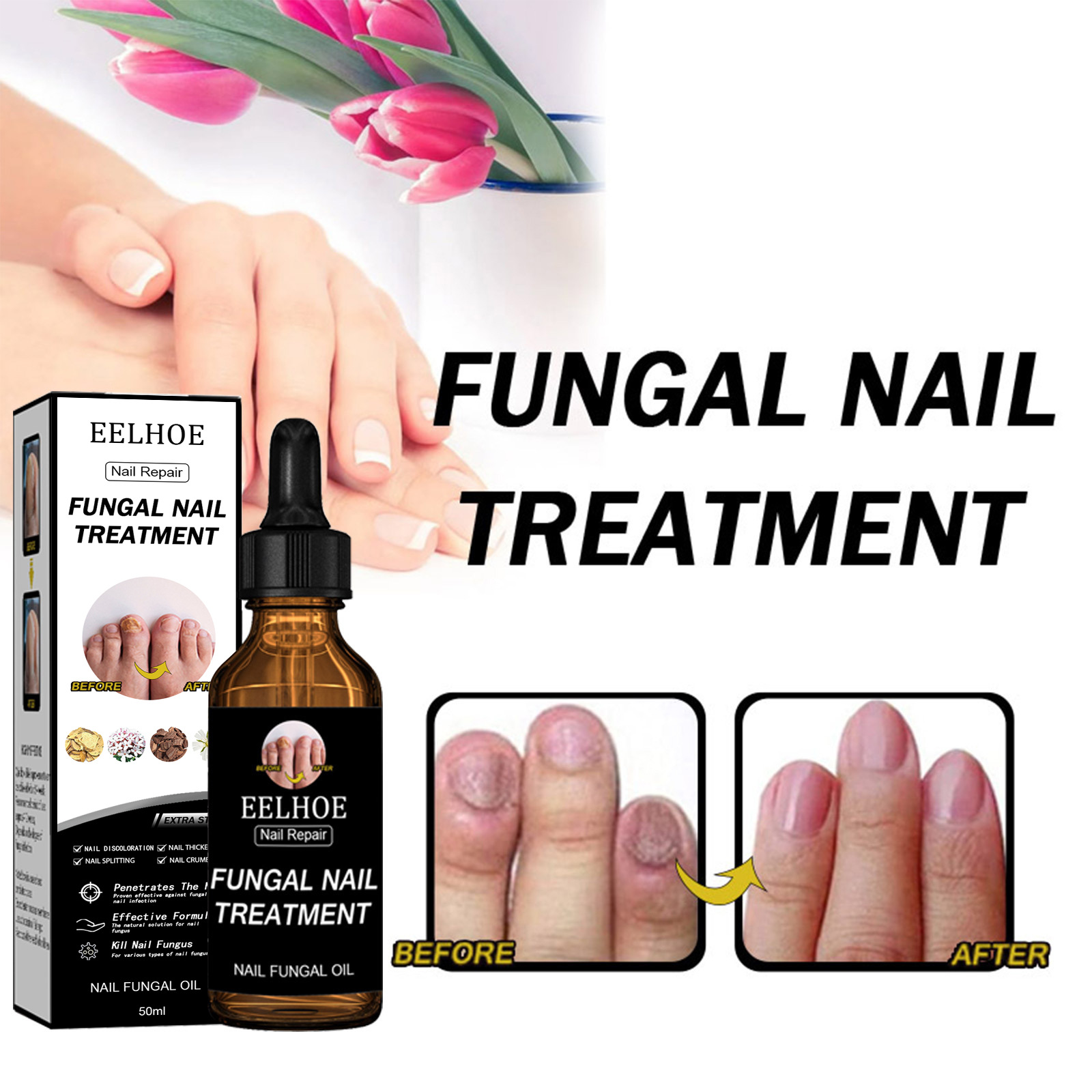 EELHOE Nail Repair Liquid - Thickening, Shining, Gray Nail Fungus Removal, Dead Skin Repair, Nourishing, Beautiful Nail Nutritional Care Liquid