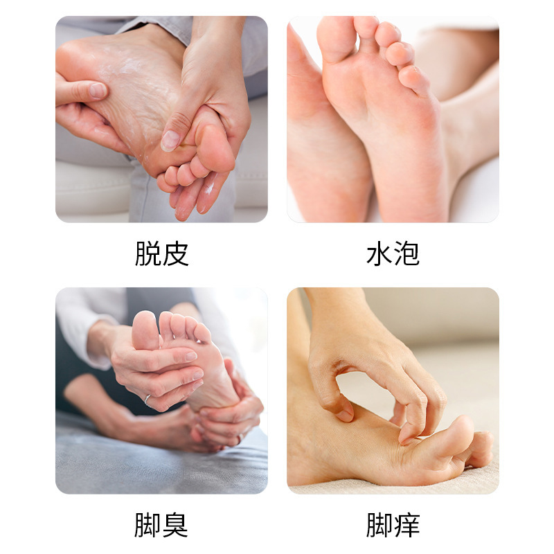 现货特一壳聚糖脚轻松喷雾剂真菌感染足癣手癣脚臭脚汗械字号喷雾|undefined
