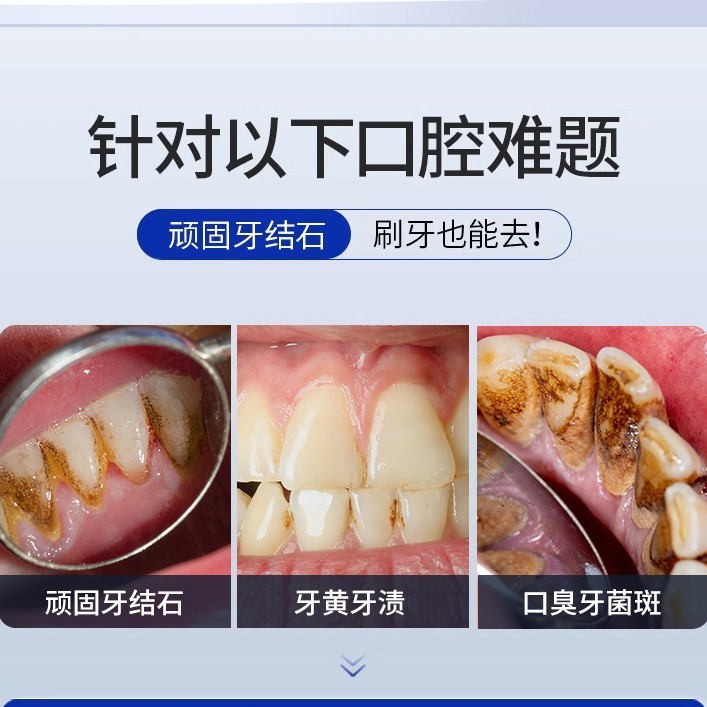 抗歯石歯磨き粉120グラム口臭歯菌斑分解汚れ黄歯黒歯黄除去歯垢歯垢歯垢|undefined