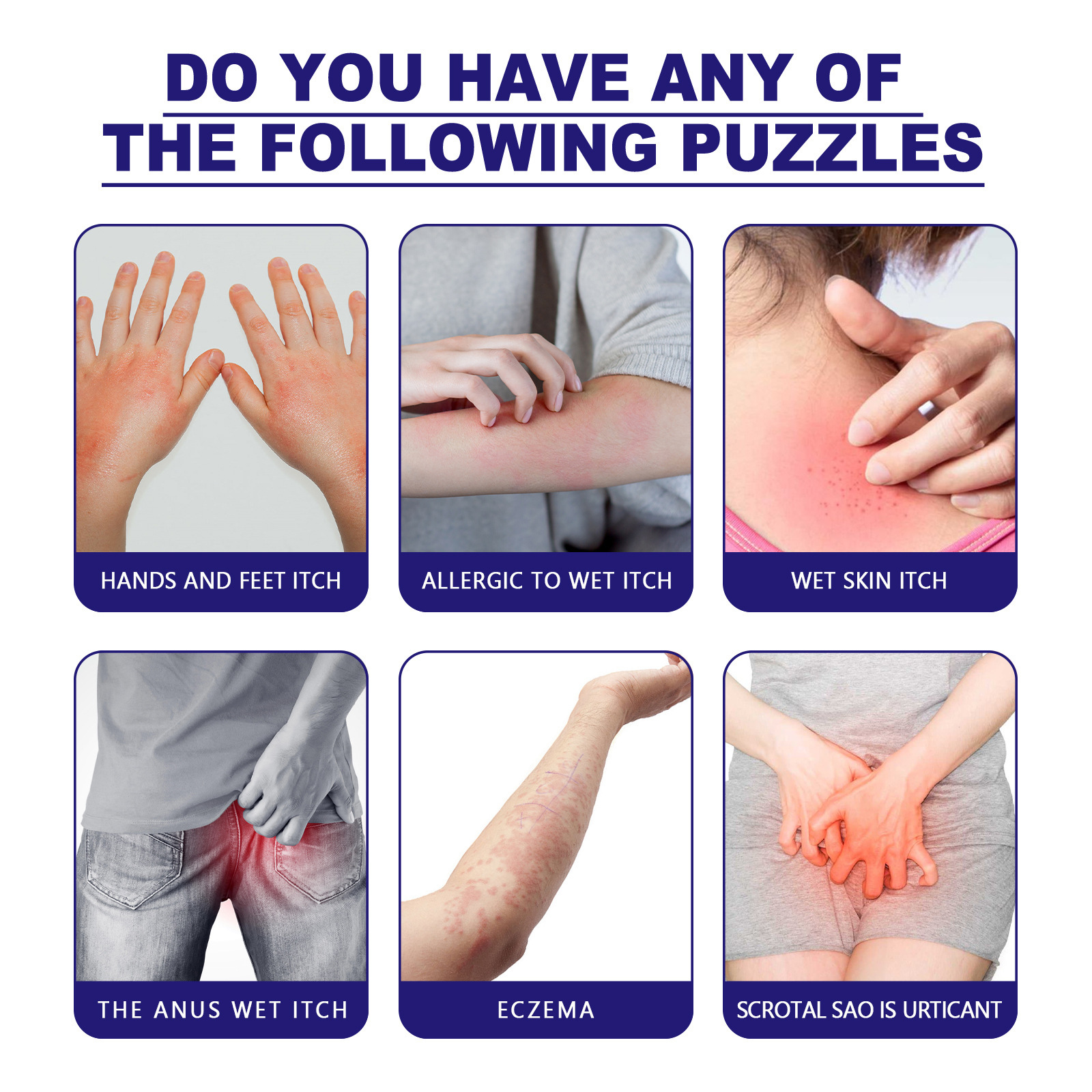 south moon紫花地丁皮膚止癢修護膏