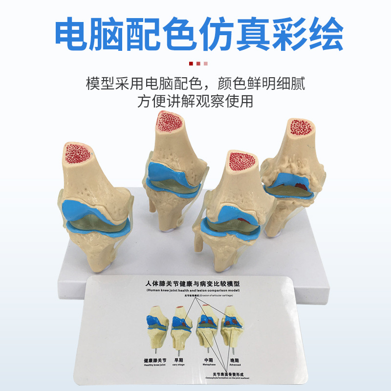 ��̬ ϥ�ؽ�ģ�� �Ľ׶β���ϥ�ؽ�ģ�� ���� ����ϥ�ؽ�ģ��