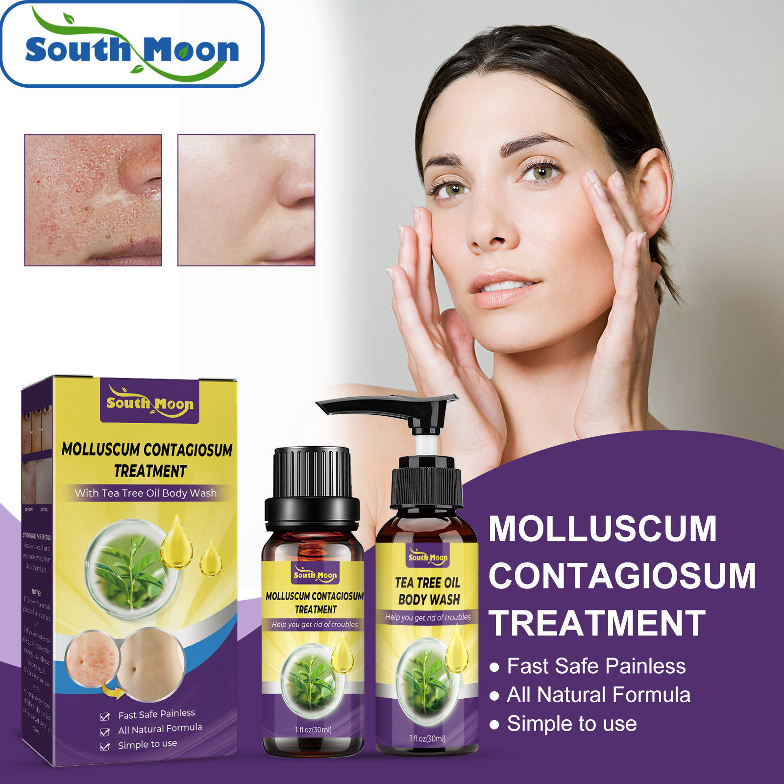 Skin Cleaning Removal of Underarm Hand and Foot Anti Wart Flat Care Liquid Set_voghion.com