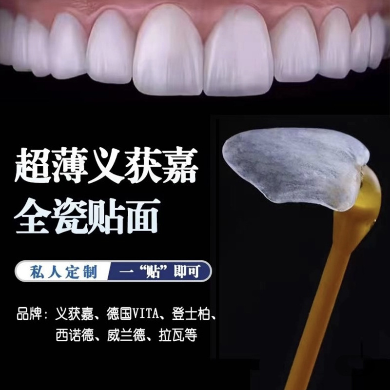 义获嘉牙科材料美牙国产瓷全瓷贴面牙齿贴片美白贴片全瓷牙贴技术