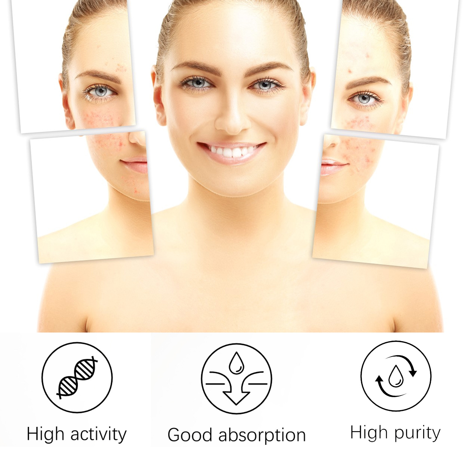 EELHOE Hautpflege reduziert Pickel, beseitigt Akne im Mund und verkleinert die Poren_voghion.com