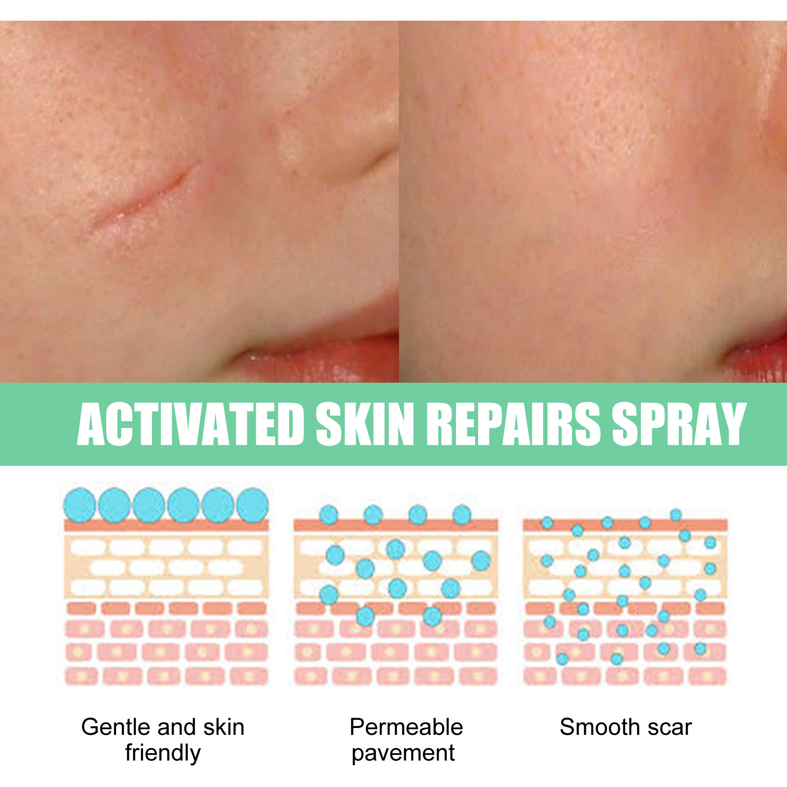 desalinates scars  pregnancy scar moisturizing repair smoothing skin care spray_voghion.com