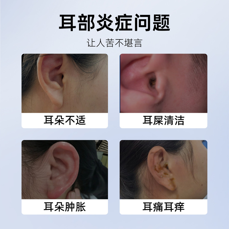 Zhengyou Pharmaceutical サリチル酸アルコール抗菌点耳薬 耳のかゆみ止め 外耳道詰まり 耳詰まり点耳薬|undefined