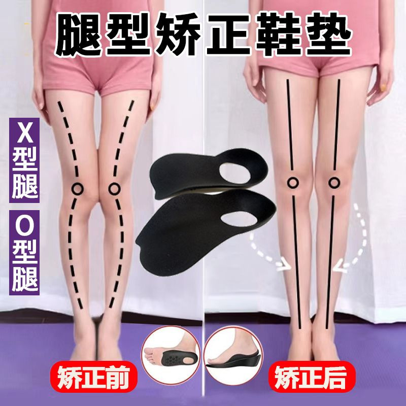 偏平足矯正インソール、足内反・外反XO型脚矯正器、アーチ崩れサポート矯正インソール、ドロップシッピング|undefined