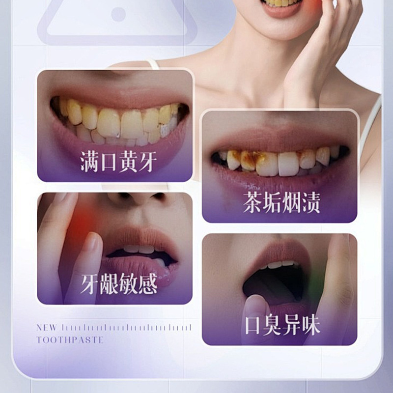 Auonam Color Repair White Dental Refrescante para eliminar manchas, amarillo, brillo, dientes limpios, aire fresco y limpio en la boca.