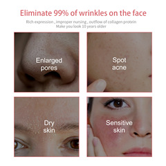 Jaysuing 5合1潔面慕斯 清潔毛孔淡化痘印去黑頭粉刺控油潔面慕斯