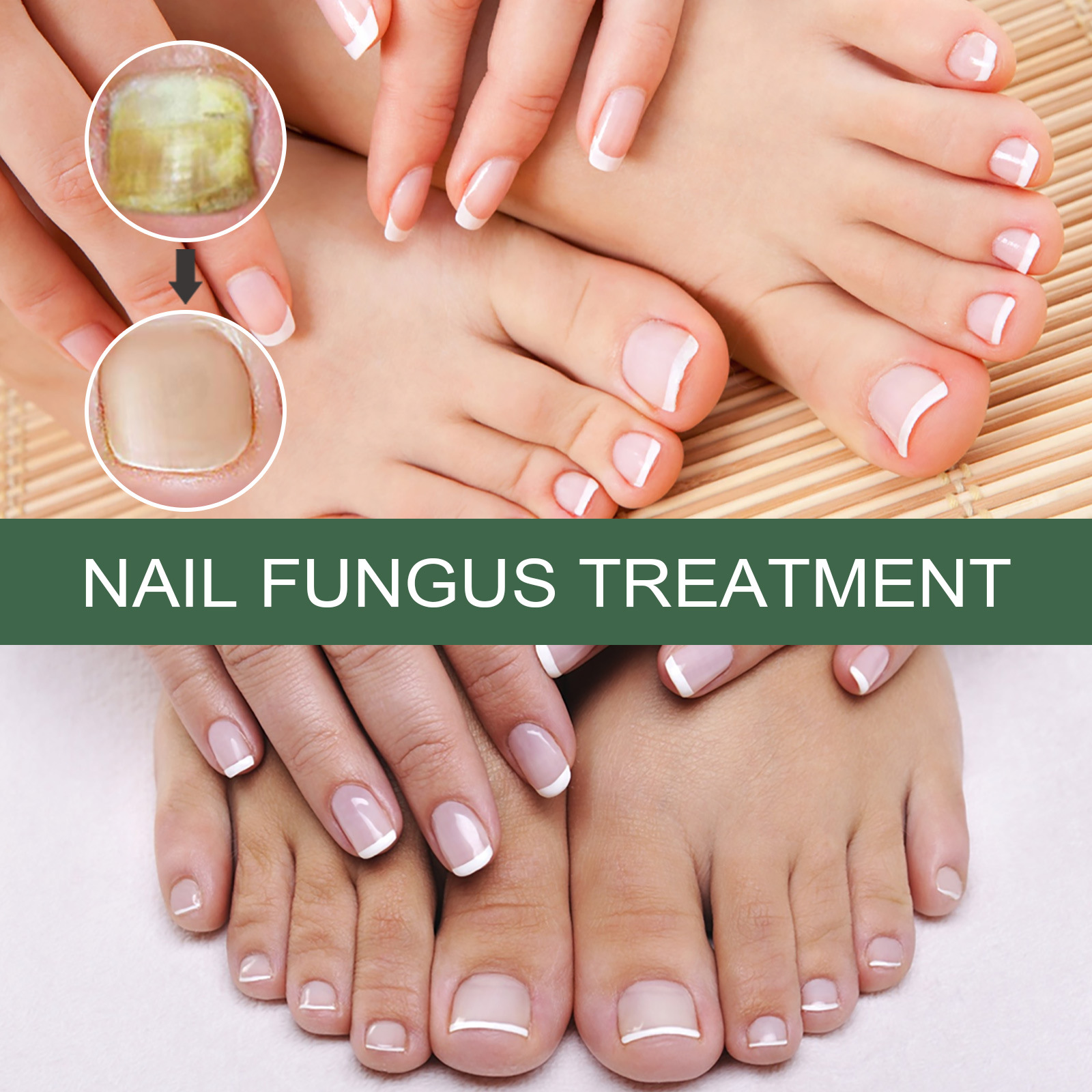 EELHOE Nail Care, una solución de hidratación suave y limpia para uñas gruesas y suaves en la superficie de las uñas. image 2