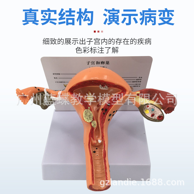 ����Ů����ֳ�ӹ����ʲ���ģ�� �����ѳ���ѧģ�� ������ֳ�ƽ̾�