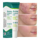 Salicanoic acid azelaic acid gel fade acne marks shrink pores acne removing closed mouth ceramide lactic acid acne removing cream